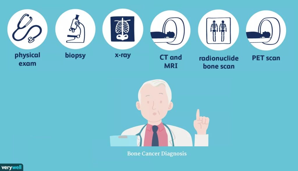 Imaging Modalities used in the Diagnosis of Skeletal Metastasis ...